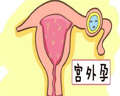 多囊卵巢降调药物治疗